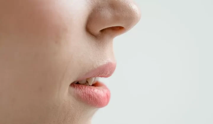 黑头护理示意图：鼻部毛孔清洁与角质管理
