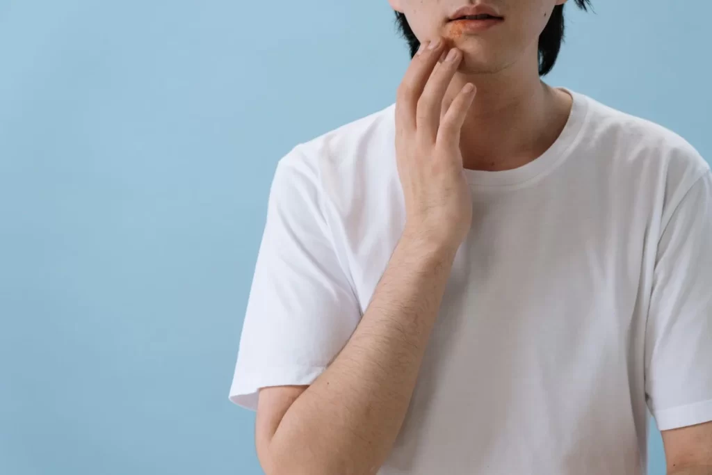 刷酸好转反应停用信号