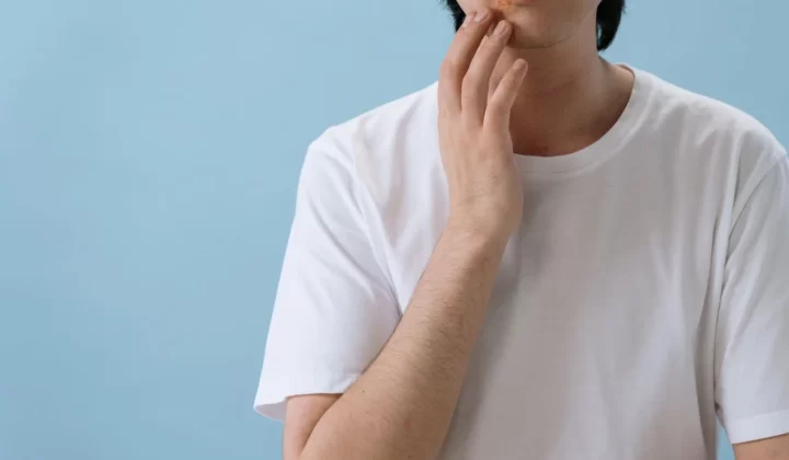 刷酸好转反应停用信号