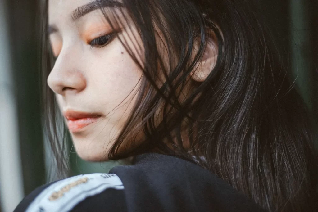 不同部位痘痘原因