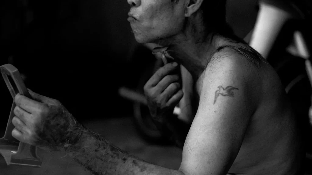 男士腋下脱毛刺激风险