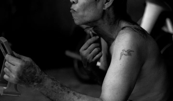 男士腋下脱毛刺激风险