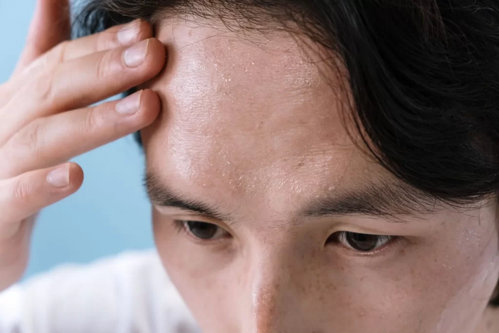 男性额头出汗,用手触摸特写