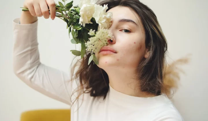 年轻女性手持白花,展现痘痘肌肤特写