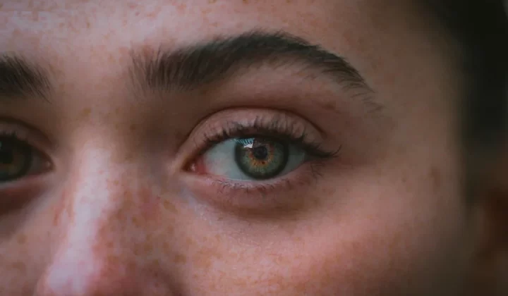 A close up of a person with freckled hair