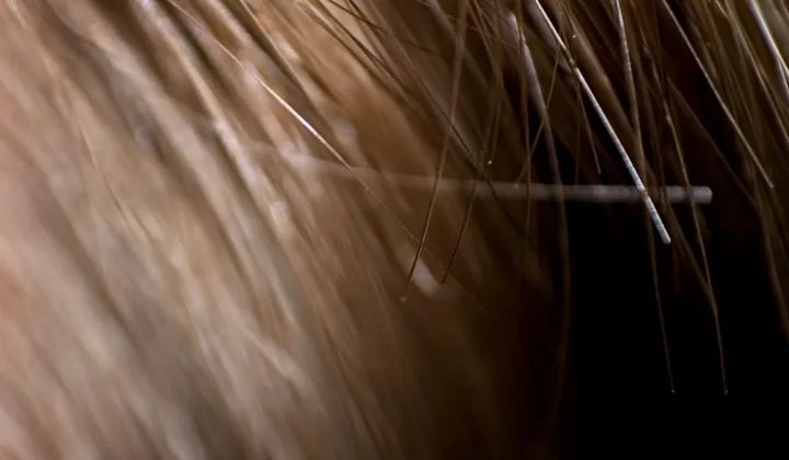 brown hair on black background