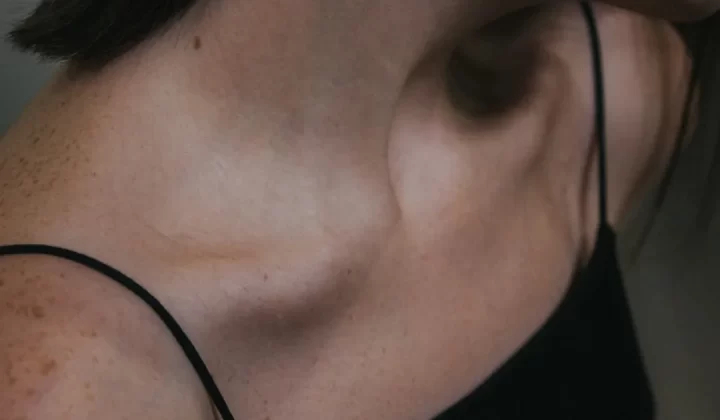 a close up of a woman with freckles on her neck