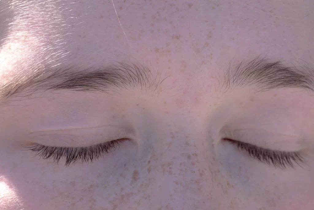 a close up of a person's eyes with freckled hair