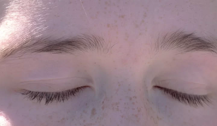 a close up of a person's eyes with freckled hair