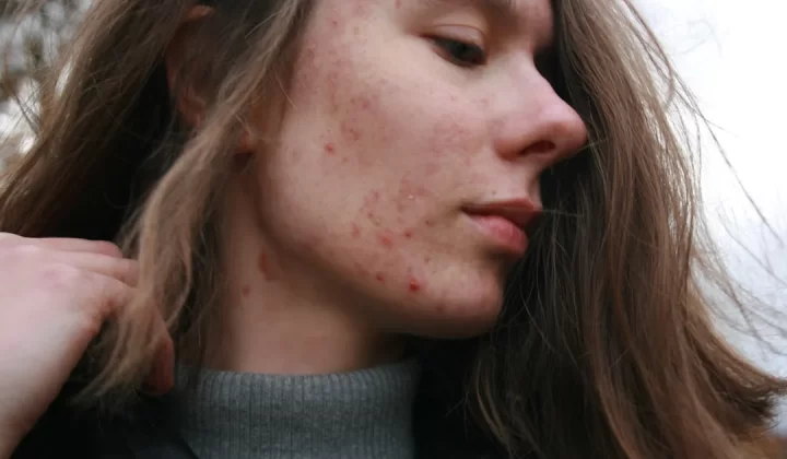 a woman with a substance on her face