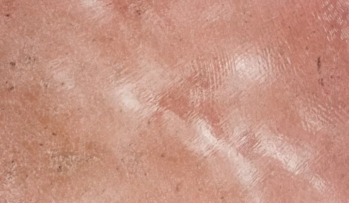 Textured pink surface with a reflective shine.